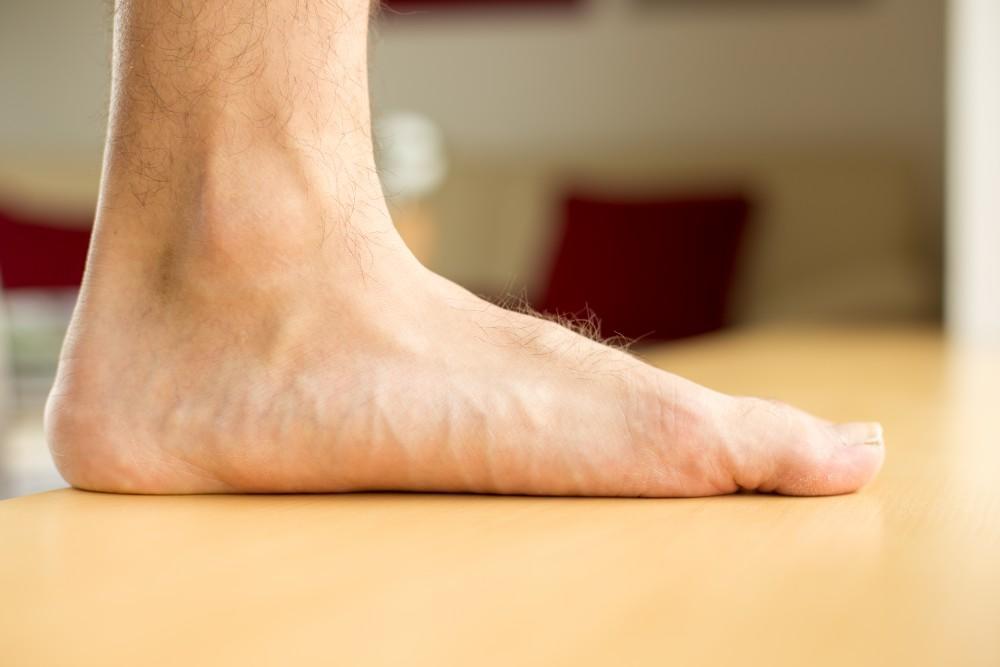 درمان صافی کف پا در کرج